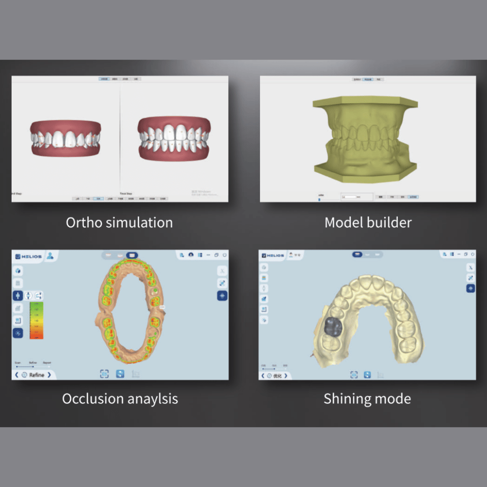 Intraoral Scanner Helios 680_ET-7680033_4